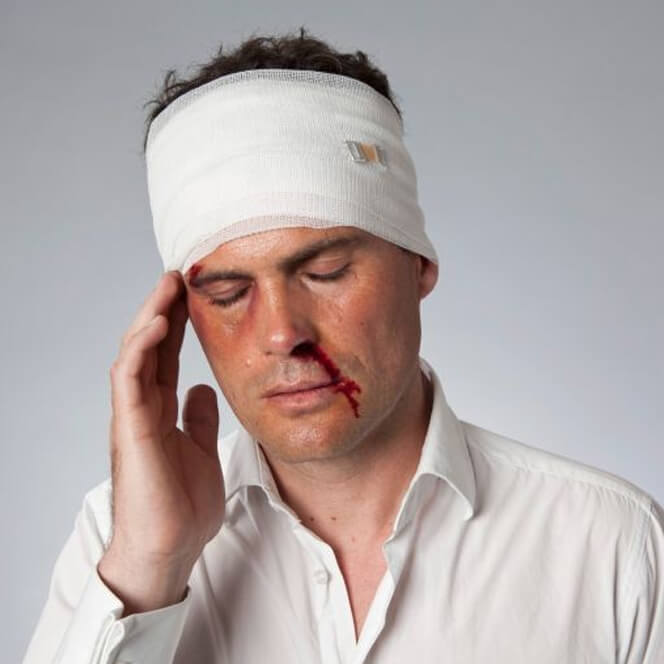 Natalie Ortiz | Brain Injury Attorney | Irvine, Ca